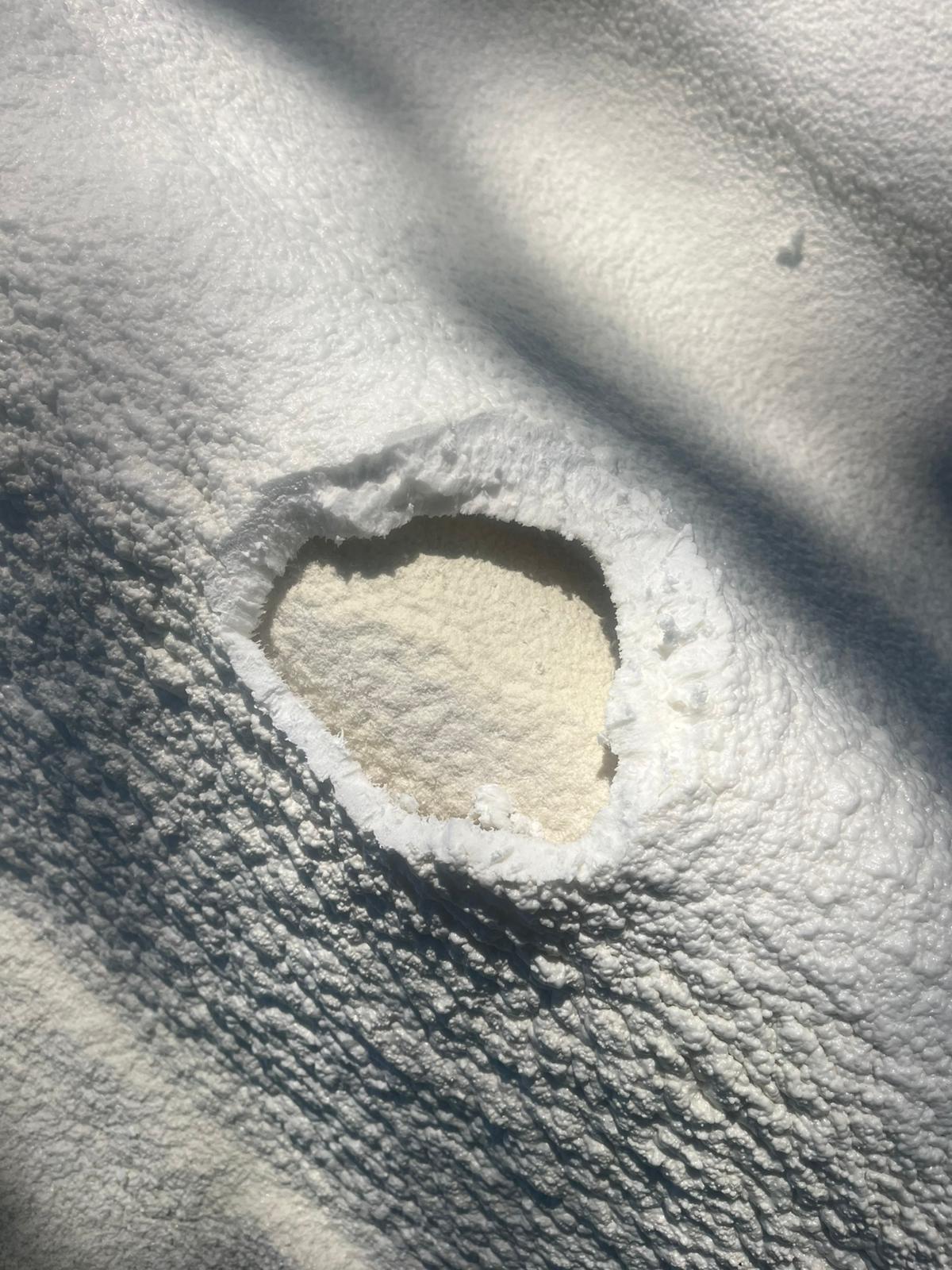 Ampolla estallata PU – blistering